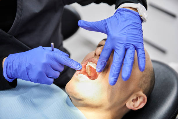 Best Emergency Root Canal Treatment in Mount Pleasant, WI